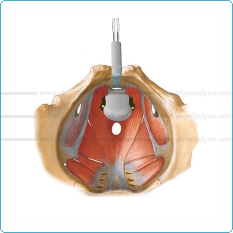 Sonde Vaginale - PERISPHERA®-U