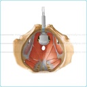 Sonde Vaginale - PERISPHERA®-U