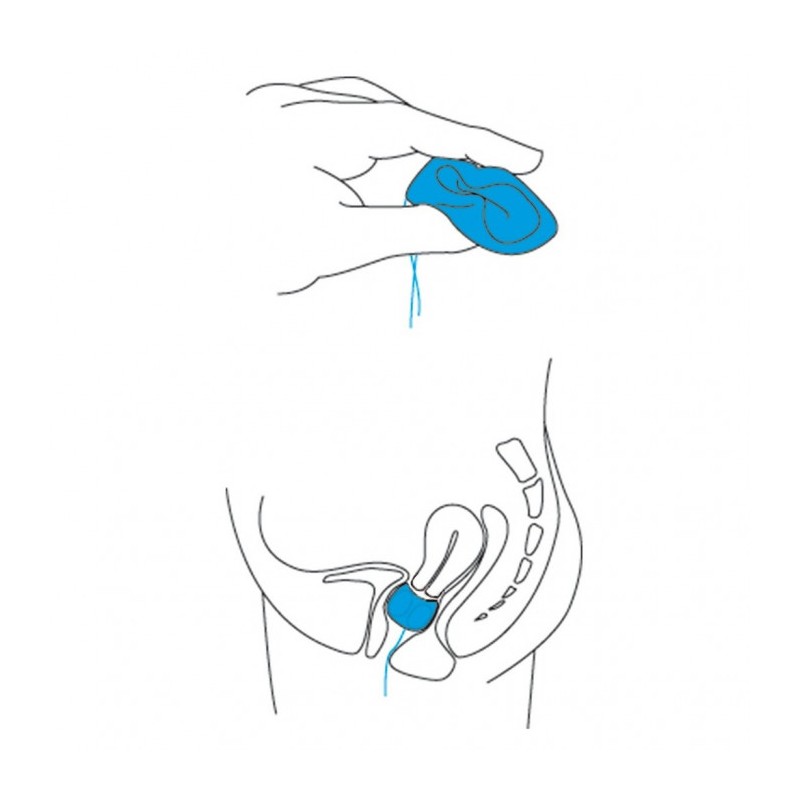 Pessaire trapézoïdal Gyn&Cube Large